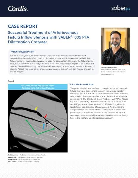 100634899_Saber-.035-Case-Study-FINAL