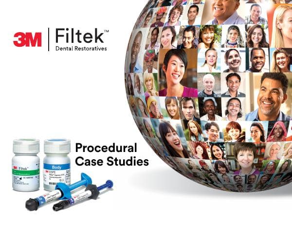 3m-filtek-dental-restoratives