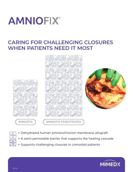 AM254.002-AMNIOFIX-Product-Brochure