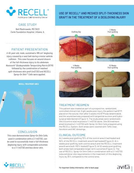 Avita_Case_Mashruwala_PRO-1013-v1_R09