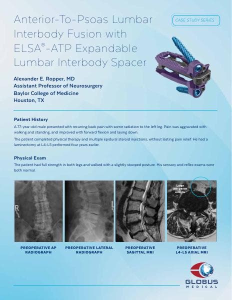 Case_19_Globus_Medical