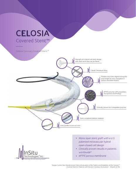 Celosia-Covered-Stent-Flyer-091323