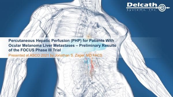 Delcath Systems_June_2021_394_71394