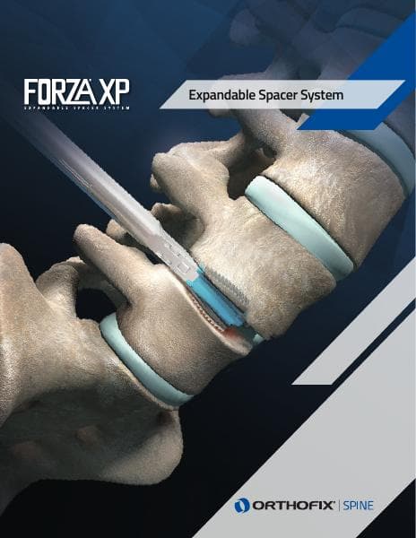 FORZA-XP-Brochure-Orthofix