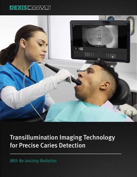 KV00699_DEXIS-CariVu-brochure-approved_digital