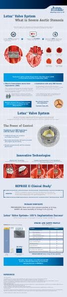 Lotus_Valve_System_Infographic_full