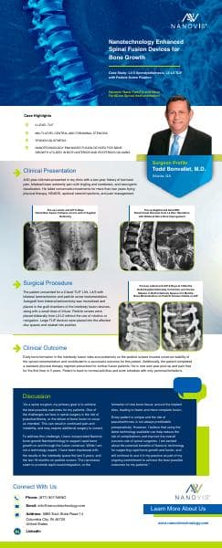 Nanovis_nanotechnology-spinal-fusion-devices