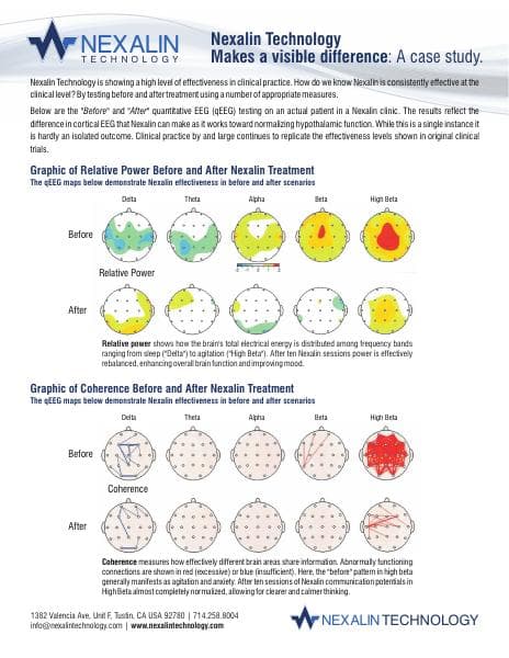NT%20QEEG%20Results%20Case%20Study