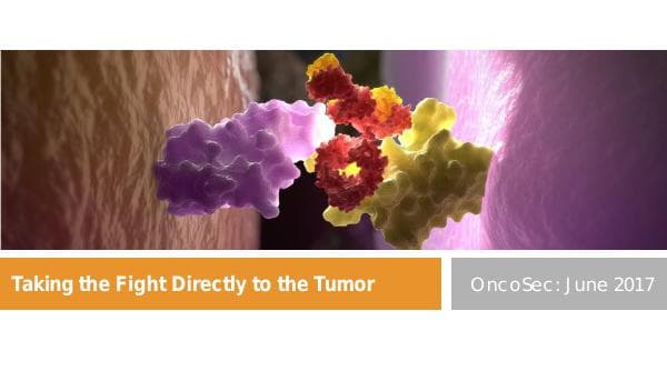 OncoSec Medical_June_2017_686_10686