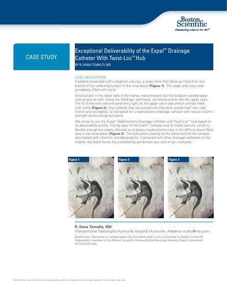 PI-379504-AA%20Expel%20Case%20Study