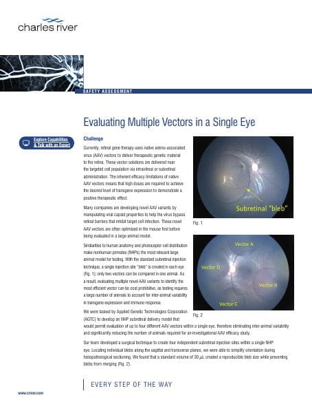 SA-Ocular-Case-Study