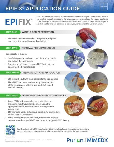 US-GS-2100021-v5.0-EPIFIX-Application-Guide